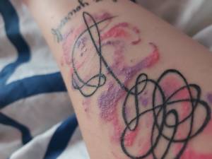 Swędząca wysypka na kolorze tatuażu pomocy