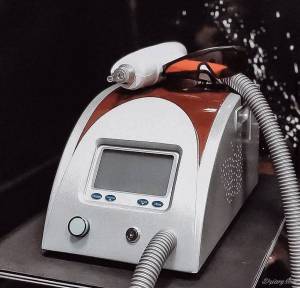 Jak szybko i skutecznie usunąć tatuaż? Sprawdź, jakie masz możliwości!