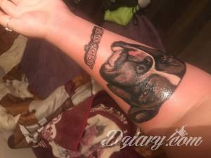 Opuchlizna na całym przedramieniu