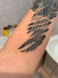 Czy to zapalenie mieszków włosowych?