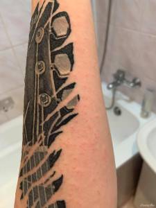 Czy to zapalenie mieszków włosowych?