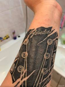 Czy to zapalenie mieszków włosowych?