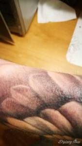 Dziwne krostki,wysypka, prośba o poradę