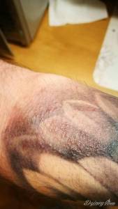 Dziwne krostki,wysypka, prośba o poradę