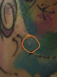 Zgrubienie na tatuażu.