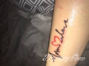 Witam. 3 dni temu zrobilem... Gojenie sie