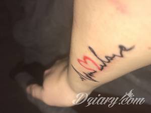 Witam. 3 dni temu zrobilem... Gojenie sie