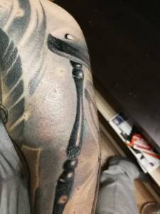 Dziwna sytaucja przy gojeniu.