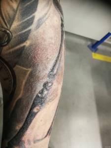 Dziwna sytaucja przy gojeniu.