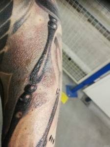 Dziwna sytaucja przy gojeniu.