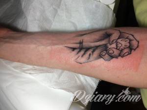 Uczulenie na nowym tatuażu