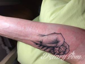 Uczulenie na nowym tatuażu