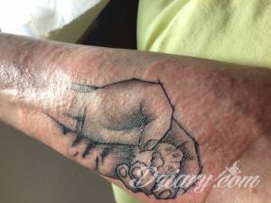 Uczulenie na nowym tatuażu