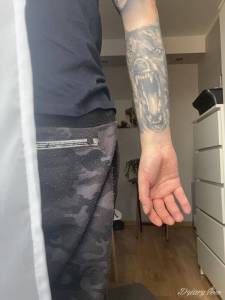 Witam. Od 7 lat męcze... Został tylko blackwork?