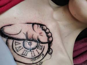 Źle gojący się tatuaż 