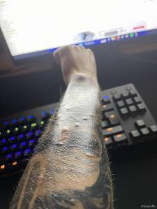 Wypryski na nowym tatuażu, pomocy