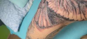 Przegrzany tatuaż 