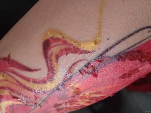 Witam :) Tatuaż robiłem w... Skóra pękła ale się nie łuszczy