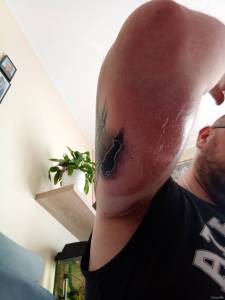 Dzień po wykonaniu tatuażu 