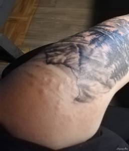 Krosty na nowym tatuażu :(