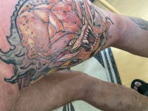 Witam,z gory nadmienie ,ze caly... Problem  z gojeniem