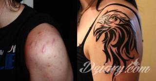 Tatuaże w formie blizny to nie tylko bezpośrednie ich odwzorowanie. Wyobraźnia idzie dalej - tworzy z blizny tatuaże niczym rozsuwane zamki do ludzkiego wnętrza. Propozycja dla tych, którzy szukają we wzorach niebanalności. 