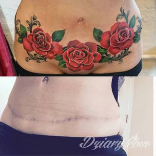 Tatuaże w formie blizny to nie tylko bezpośrednie ich odwzorowanie. Wyobraźnia idzie dalej - tworzy z blizny tatuaże niczym rozsuwane zamki do ludzkiego wnętrza. Propozycja dla tych, którzy szukają we wzorach niebanalności. 