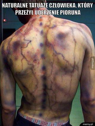 Naturalne tatuaże człowieka który przeżył uderzenie piorunem